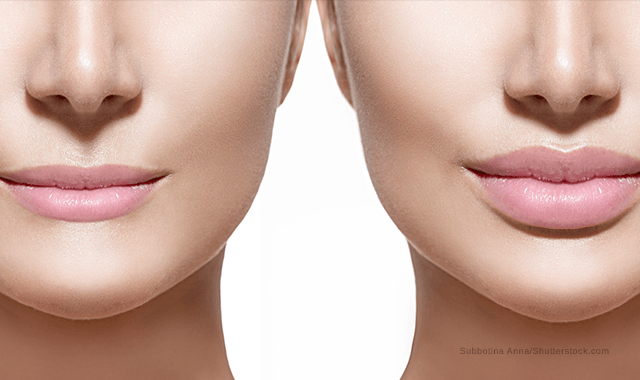 Behandelen van de lippen