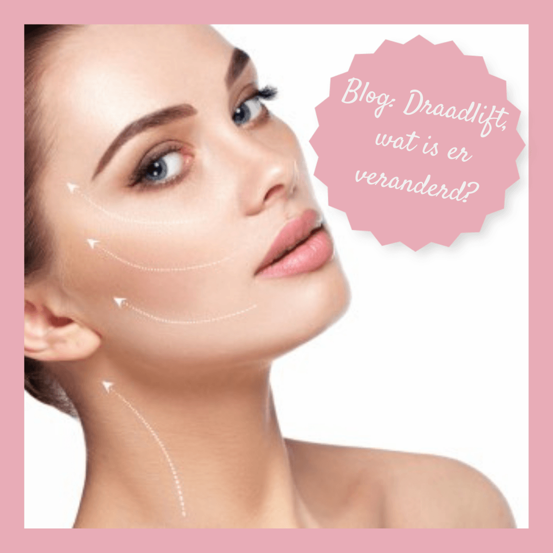 blog over draadlift
