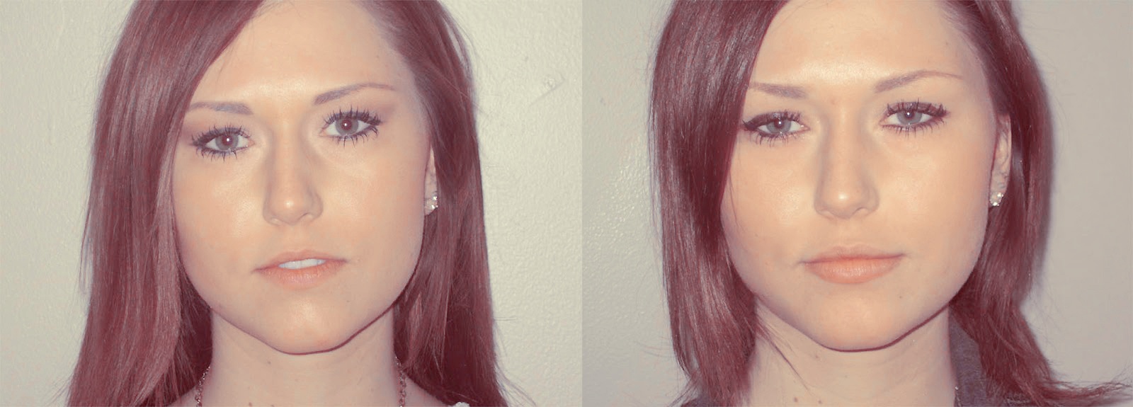 Behandelen lippen
