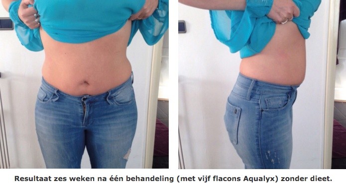MooiMedischSportief_Aqualyx_02