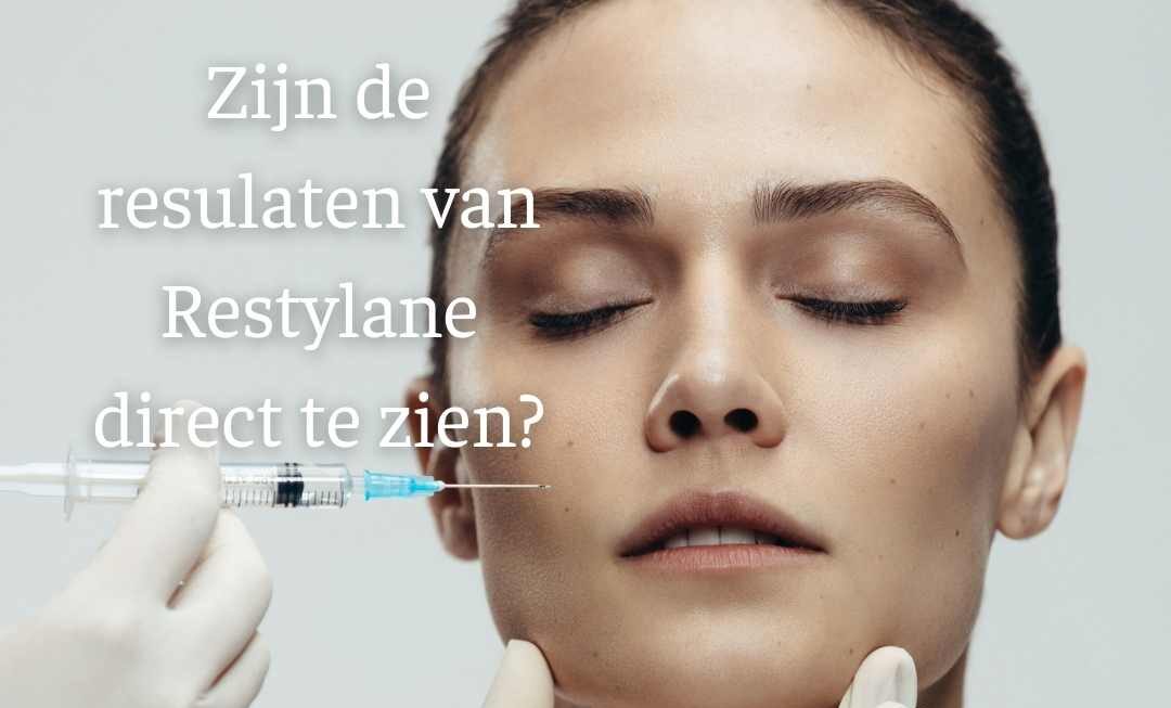 Restylane efffecten direct te zien?