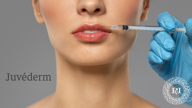 Juvéderm filler