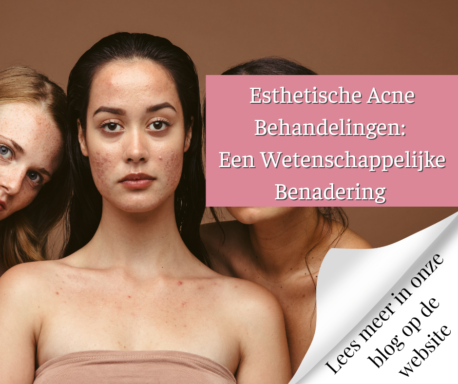 Esthetische Acne Behandelingen Een Wetenschappelijke Benadering