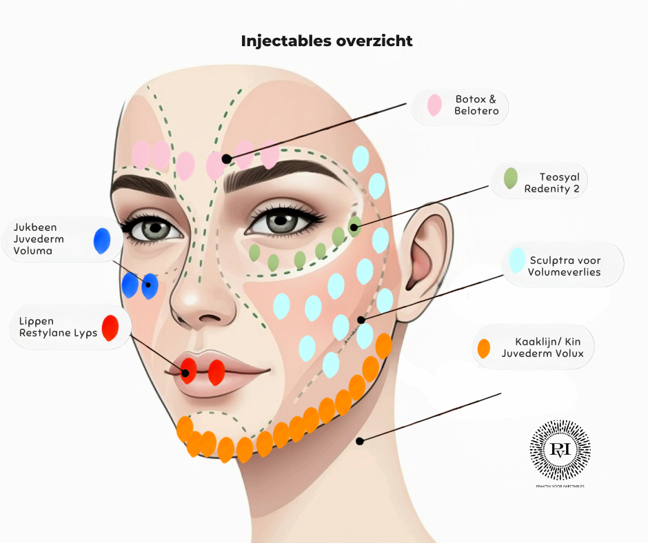 Infographic injectables overzicht